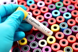 Legionella Sampling during COVID 19